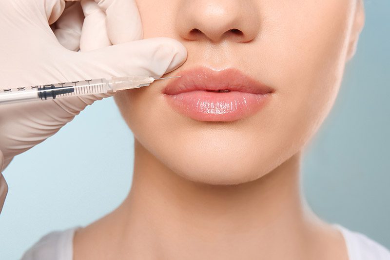 Cosmetic fillers